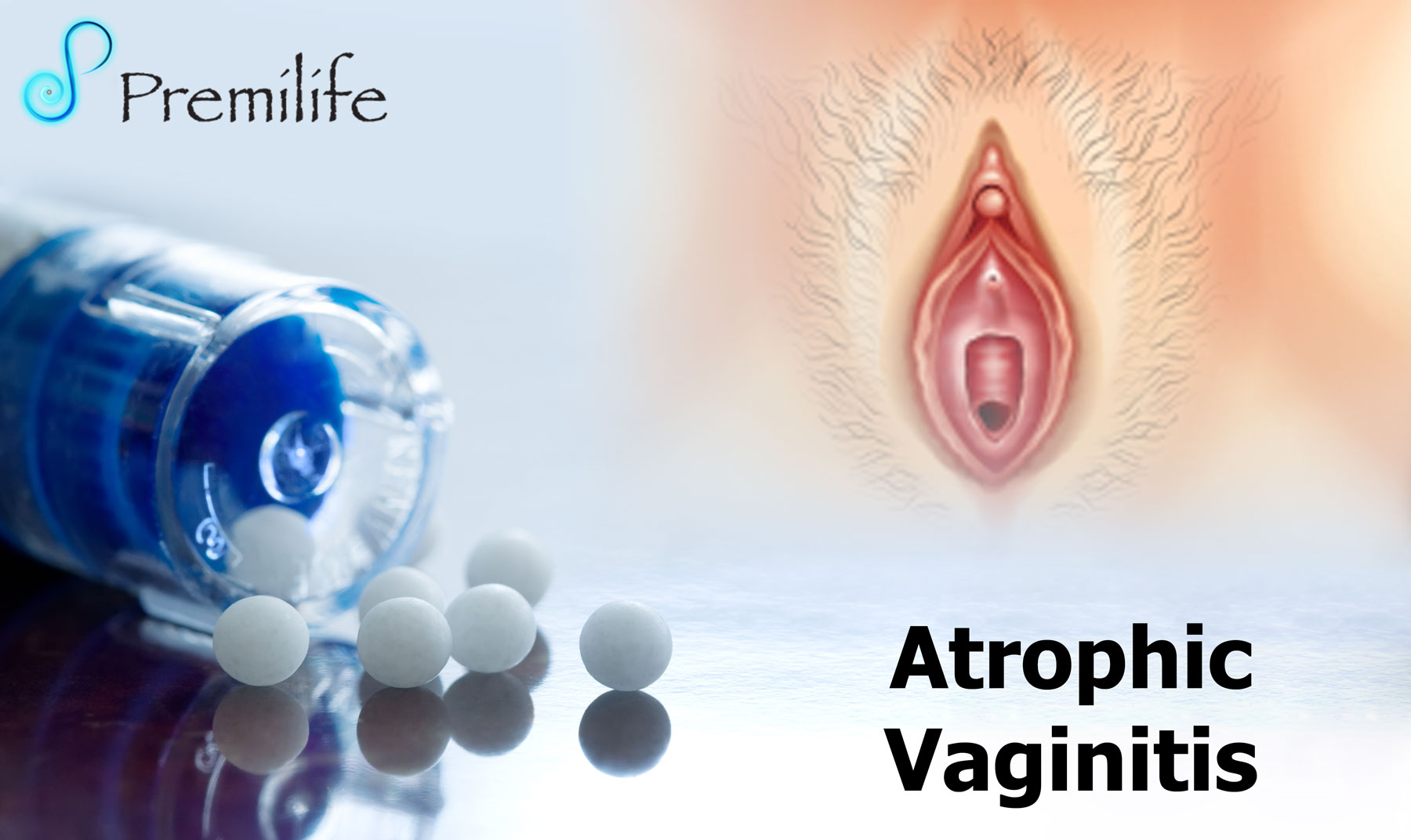 Atrophic Vaginitis  Premilife - Homeopathic Remedies